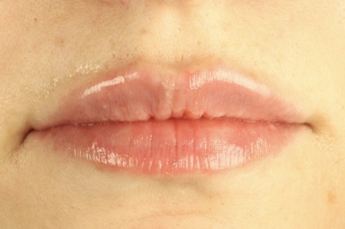 After